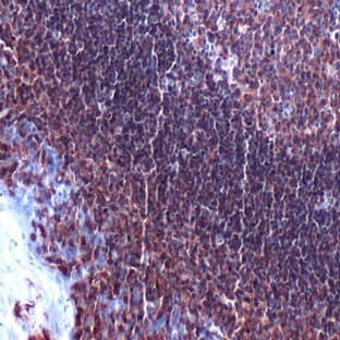 anti-CD4 Molecule (CD4) (Internal Region) antibody avatar