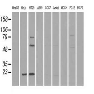 anti-CD4 Molecule (CD4) (Transcript Variant 1) antibody avatar