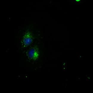 anti-CD4 Molecule (CD4) (Transcript Variant 1) antibody avatar