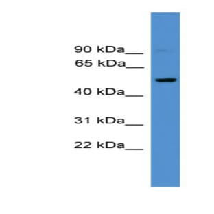 anti-CD4 Molecule (CD4) (C-Term) antibody avatar