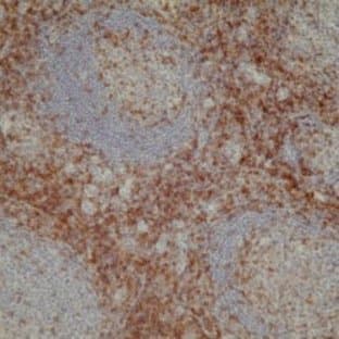 anti-CD4 Molecule (CD4) antibody avatar