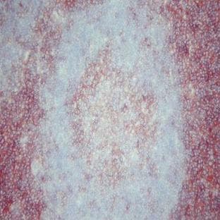 anti-CD4 Molecule (CD4) antibody avatar