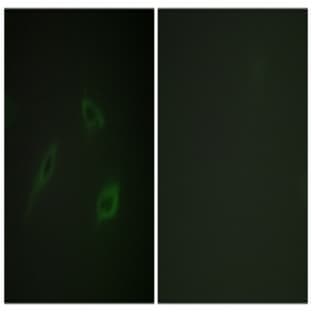 anti-CD4 Molecule (CD4) antibody avatar