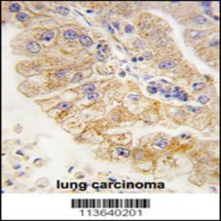 anti-CD4 Molecule (CD4) (C-Term), (AA 408-436) antibody avatar