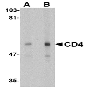 anti-CD4 Molecule (CD4) (N-Term) antibody avatar
