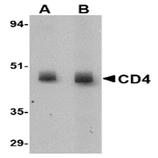 anti-CD4 Molecule (CD4) (N-Term) antibody avatar