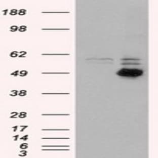 anti-CD4 Molecule (CD4) (Transcript Variant 1) antibody avatar