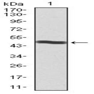 anti-CD5 Molecule (CD5) (AA 27-233) antibody avatar