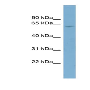 anti-CD5 Molecule (CD5) (N-Term) antibody avatar