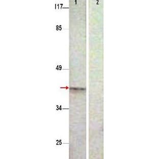 anti-Aurora Kinase B (AURKB) (pThr232), (Internal Region) antibody