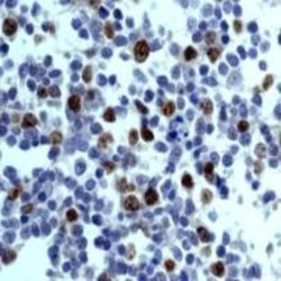 anti-Aurora Kinase B (AURKB) (N-Term) antibody avatar