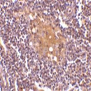 anti-CD5 Molecule-Like (CD5L) (C-Term) antibody avatar