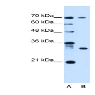 anti-ATPase, H+ Transporting, Lysosomal Accessory Protein 1-Like (ATP6AP1L) (C-Term) antibody avatar