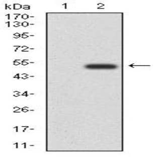 anti-CD6 (CD6) (AA 472-668) antibody avatar