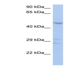 anti-Acid Phosphatase-Like 2 (ACPL2) (Middle Region) antibody avatar