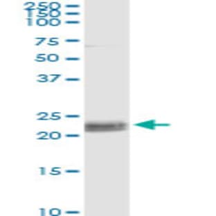 anti-CD8a Molecule (CD8A) antibody avatar