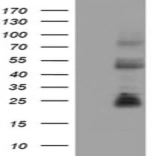 anti-CD8 Antigen, alpha Polypeptide (CD8A) antibody avatar