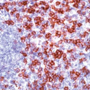 anti-CD8a Molecule (CD8A) (C-Term), (Cytoplasmic Domain) antibody avatar