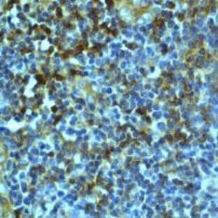 anti-CD8a Molecule (CD8A) (C-Term) antibody avatar