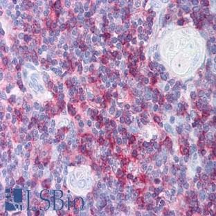 anti-CD8 Antigen, alpha Polypeptide (CD8A) (C-Term) antibody avatar