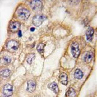 anti-CD8a Molecule (CD8A) (C-Term) antibody avatar