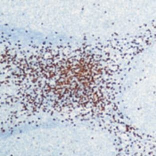 anti-CD8 Antigen, alpha Polypeptide (CD8A) antibody avatar