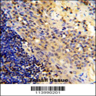 anti-CD8a Molecule (CD8A) (N-Term), (AA 59-88) antibody