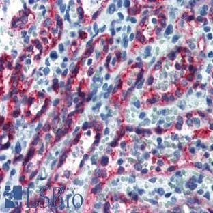 anti-CD8 Antigen, alpha Polypeptide (CD8A) (C-Term) antibody avatar