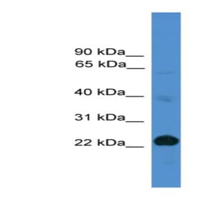 anti-CD8a Molecule (CD8A) (Middle Region) antibody