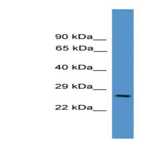 anti-CD8a Molecule (CD8A) (Middle Region) antibody