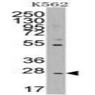 anti-CD8b Molecule (CD8B) (N-Term) antibody avatar