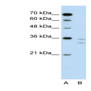 anti-CD8b Molecule (CD8B) (N-Term) antibody avatar