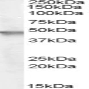 anti-Cytohesin 2 (CYTH2) (N-Term) antibody avatar