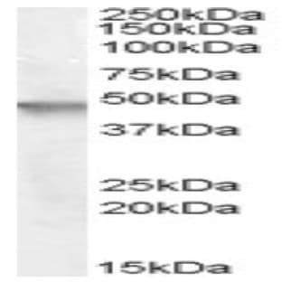 anti-Cytohesin 2 (CYTH2) (N-Term) antibody avatar