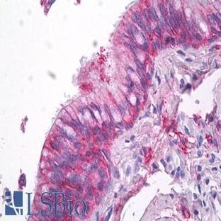 anti-CD9 (CD9) antibody avatar