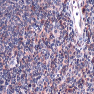 anti-CD9 (CD9) antibody avatar