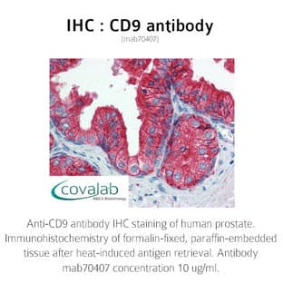 anti-CD9 (CD9) antibody avatar