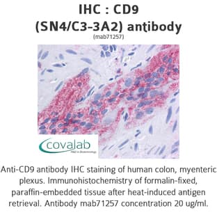 anti-CD9 (CD9) antibody avatar