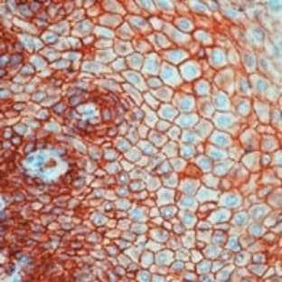 anti-CD9 (CD9) (Extracellular Loop) antibody avatar