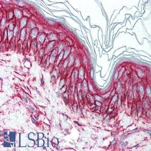 anti-CD9 (CD9) antibody avatar