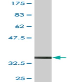 anti-CD9 (CD9) (AA 112-195) antibody avatar