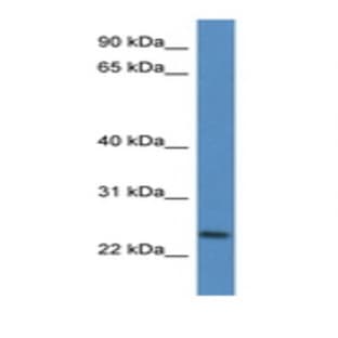 anti-CD9 (CD9) (N-Term) antibody avatar