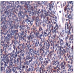 anti-CD9 (CD9) antibody avatar