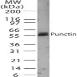 anti-ADAMTS-Like 1 (ADAMTSL1) (AA 226-240) antibody avatar
