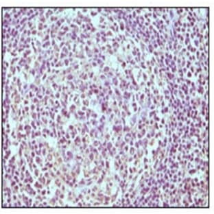 anti-CD19 Molecule (CD19) antibody avatar