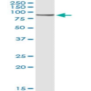 anti-CD19 Molecule (CD19) antibody avatar