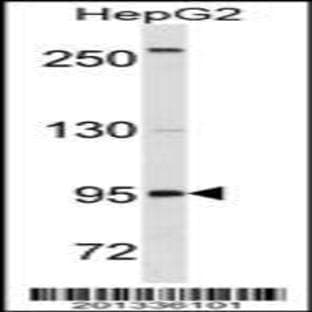 anti-CD19 Molecule (CD19) antibody avatar
