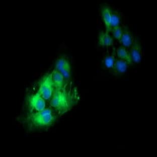 anti-CD19 Molecule (CD19) antibody avatar