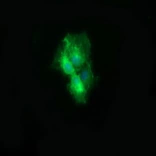 anti-CD19 Molecule (CD19) antibody avatar