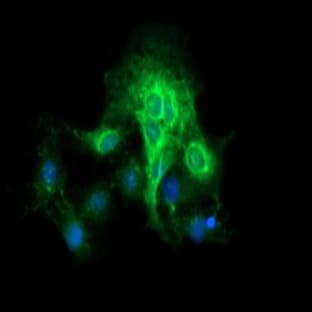 anti-CD19 Molecule (CD19) antibody avatar